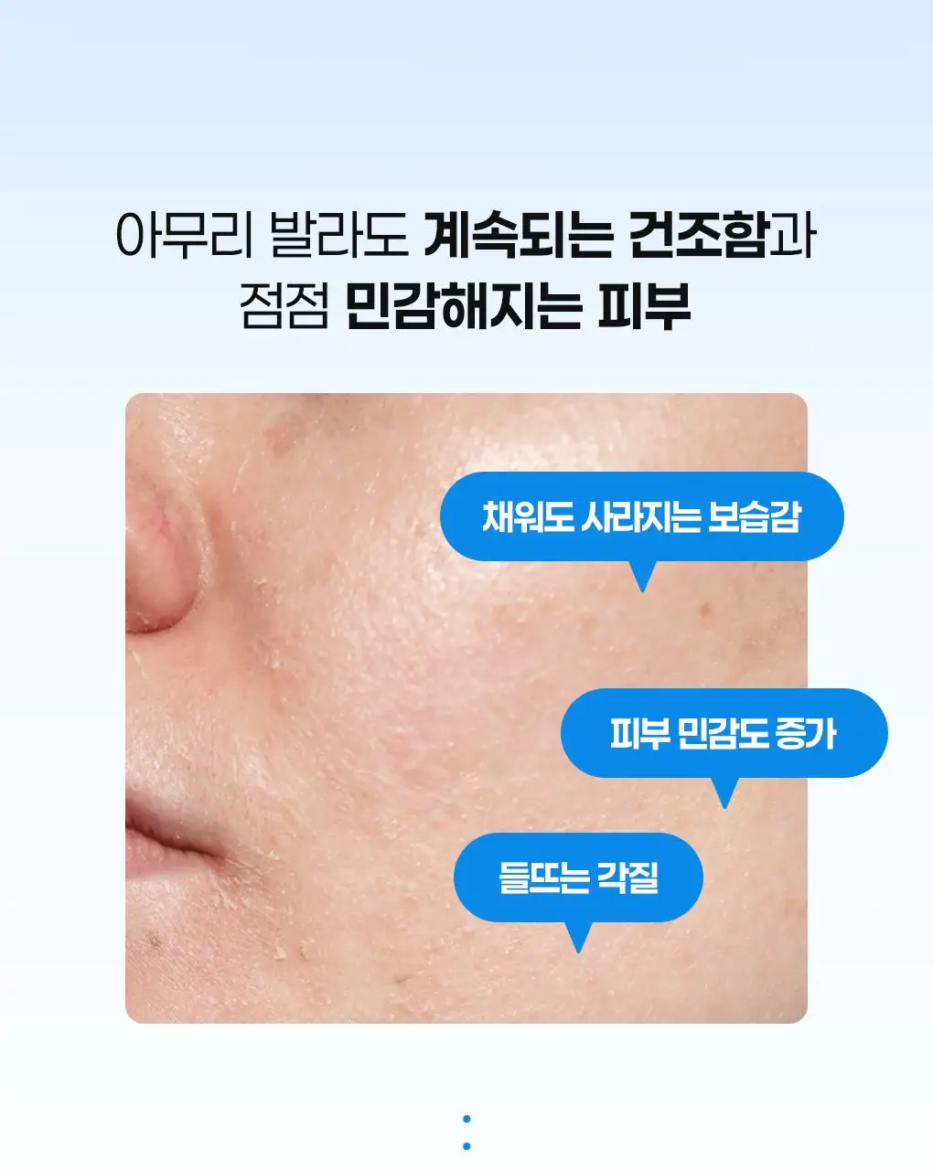 [수분보습폭탄] 빌리프 아쿠아 밤 / 모이스춰라이징 밤 30ml 기획 (+뉴메로10 에센스 35ml) 상세페이지 12